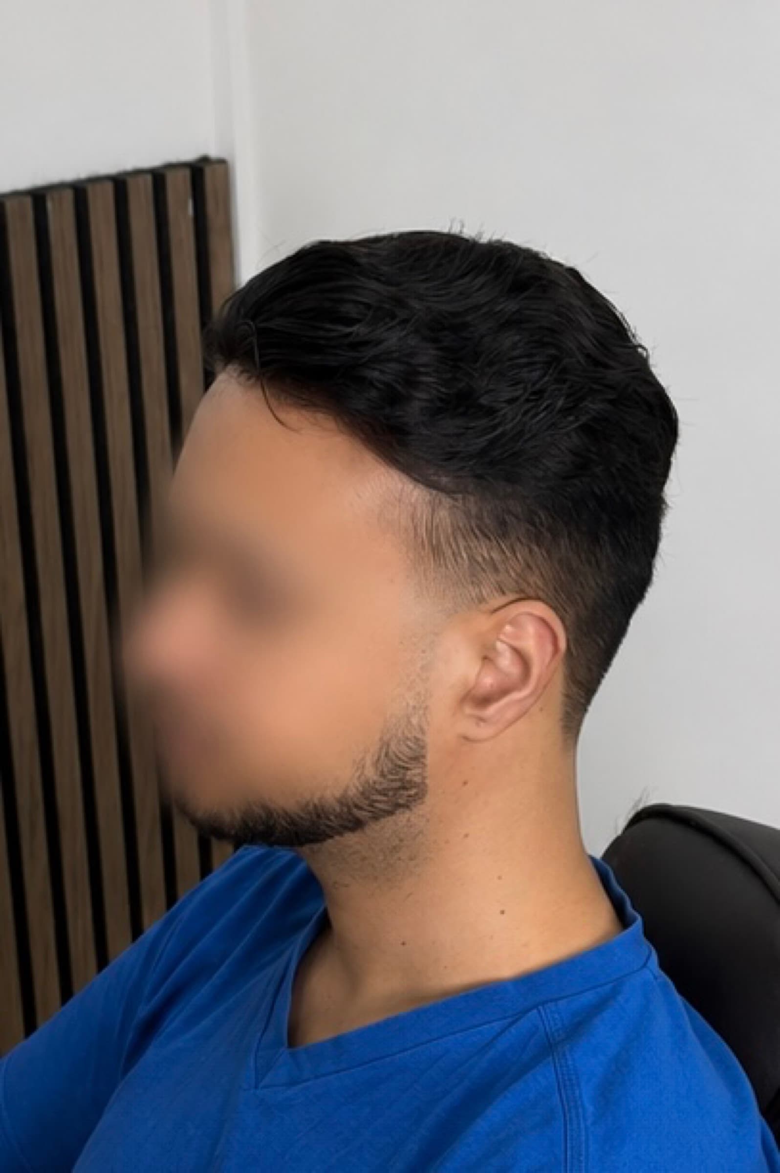 Finished front profile with fuller balanced coverage.